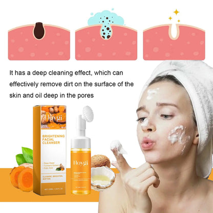 Turmeric Acne Foam Cleanser